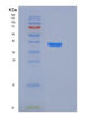 SDS-PAGE analysis of Human ADM (Pro-Adrenomedullin) - Recombinant Protein, showing >90% purity under 15% SDS-PAGE (Reduced)