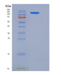 SDS-PAGE analysis of Human ACLY (Atp-Citrate Synthase) - Recombinant Protein, showing >85% purity under 15% SDS-PAGE (Reduced)