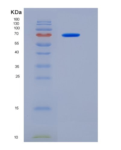SDS-PAGE analysis of Human MTSS1 (Protein Mtss 1) - Recombinant Protein, showing >95% purity under 15% SDS-PAGE (Reduced)