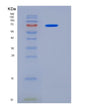 SDS-PAGE analysis of Human MTSS1 (Protein Mtss 1) - Recombinant Protein, showing >95% purity under 15% SDS-PAGE (Reduced)