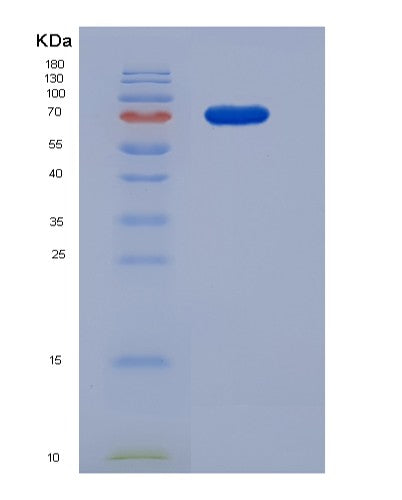 SDS-PAGE analysis of Human F13B (Coagulation Factor Xiii B Chain) - Recombinant Protein, showing >90% purity under 15% SDS-PAGE (Reduced)