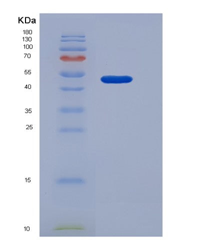 SDS-PAGE analysis of Human IL2RB (Interleukin-2 Receptor Subunit Beta) - Recombinant Protein, showing >85% purity under 15% SDS-PAGE (Reduced)