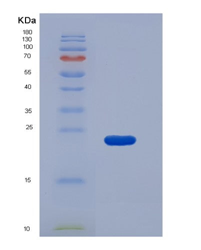 SDS-PAGE analysis of Mouse Procr (Endothelial Protein C Receptor) - Recombinant Protein, showing >95% purity under 15% SDS-PAGE (Reduced)