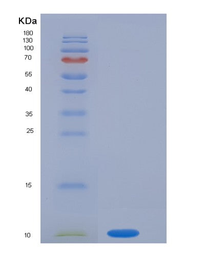SDS-PAGE analysis of Human S100P (Protein S100-P) - Recombinant Protein, showing >85% purity under 15% SDS-PAGE (Reduced)