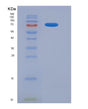 SDS-PAGE analysis of Human CD93 (Complement Component C1Q Receptor) - Recombinant Protein, showing >95% purity under 15% SDS-PAGE (Reduced)