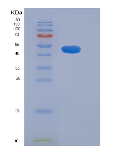 SDS-PAGE analysis of Human ADAM15 (Disintegrin And Metalloproteinase Domain-Containing Protein 15) - Recombinant Protein, showing >90% purity under 15% SDS-PAGE (Reduced)