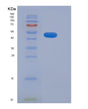 SDS-PAGE analysis of Human ADAM15 (Disintegrin And Metalloproteinase Domain-Containing Protein 15) - Recombinant Protein, showing >90% purity under 15% SDS-PAGE (Reduced)