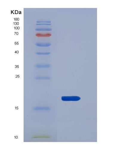 SDS-PAGE analysis of Mouse Reg3b (Regenerating Islet-Derived Protein 3-Beta) - Recombinant Protein, showing >85% purity under 15% SDS-PAGE (Reduced)