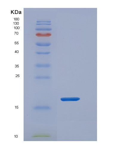 SDS-PAGE analysis of Human REG3A (Regenerating Islet-Derived Protein 3-Alpha) - Recombinant Protein, showing >95% purity under 15% SDS-PAGE (Reduced)