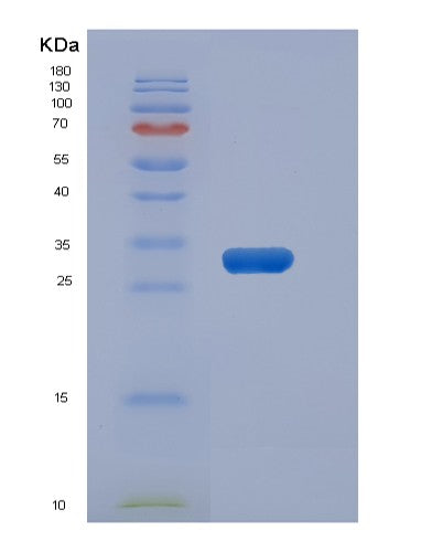 SDS-PAGE analysis of Human METAP1D (Methionine Aminopeptidase 1D, Mitochondrial) - Recombinant Protein, showing >90% purity under 15% SDS-PAGE (Reduced)