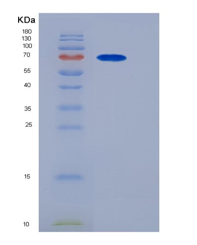 SDS-PAGE analysis of Mouse Csk (Tyrosine-Protein Kinase Csk) - Recombinant Protein, showing >95% purity under 15% SDS-PAGE (Reduced)