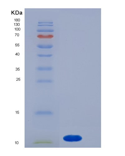 SDS-PAGE analysis of Human S100A7 (Protein S100-A7) - Recombinant Protein, showing >85% purity under 15% SDS-PAGE (Reduced)