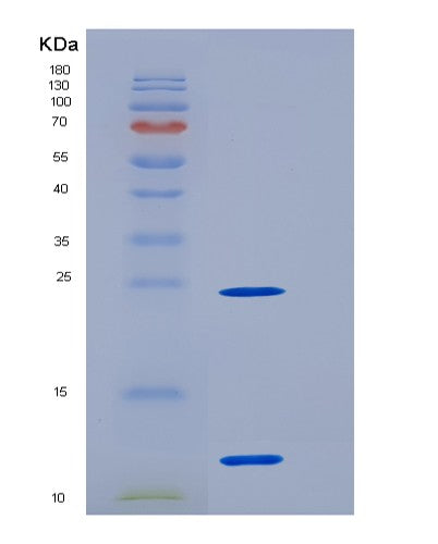 SDS-PAGE analysis of Human S100A11 (Protein S100-A11) - Recombinant Protein, showing >95% purity under 15% SDS-PAGE (Reduced)