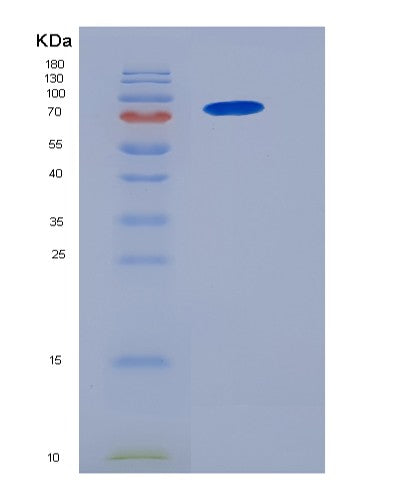 SDS-PAGE analysis of Human NCF2 (Neutrophil Cytosol Factor 2) - Recombinant Protein, showing >85% purity under 15% SDS-PAGE (Reduced)