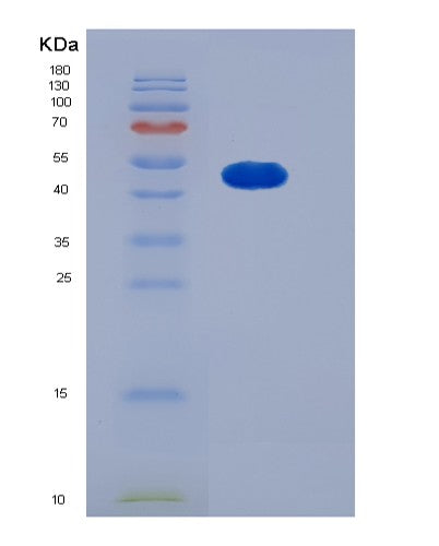 SDS-PAGE analysis of Human SMYD2 (N-Lysine Methyltransferase Smyd2) - Recombinant Protein, showing >90% purity under 15% SDS-PAGE (Reduced)