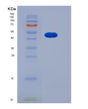 SDS-PAGE analysis of Human SMYD2 (N-Lysine Methyltransferase Smyd2) - Recombinant Protein, showing >90% purity under 15% SDS-PAGE (Reduced)