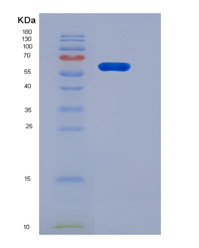 SDS-PAGE analysis of Human IGSF8 (Immunoglobulin Superfamily Member 8) - Recombinant Protein, showing >95% purity under 15% SDS-PAGE (Reduced)