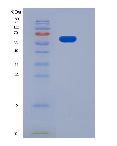 SDS-PAGE analysis of Human EPHB1 (Ephrin Type-B Receptor 1) - Recombinant Protein, showing >85% purity under 15% SDS-PAGE (Reduced)