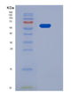 SDS-PAGE analysis of Human EPHB1 (Ephrin Type-B Receptor 1) - Recombinant Protein, showing >85% purity under 15% SDS-PAGE (Reduced)