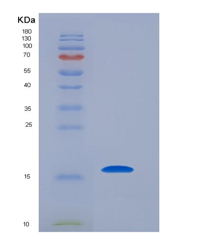 SDS-PAGE analysis of Human BIRC5 (Baculoviral Iap Repeat-Containing Protein 5) - Recombinant Protein, showing >85% purity under 15% SDS-PAGE (Reduced)