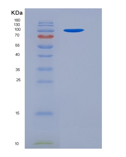 SDS-PAGE analysis of Mouse Vcl (Vinculin) - Recombinant Protein, showing >95% purity under 15% SDS-PAGE (Reduced)