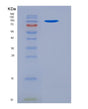 SDS-PAGE analysis of Mouse Vcl (Vinculin) - Recombinant Protein, showing >95% purity under 15% SDS-PAGE (Reduced)