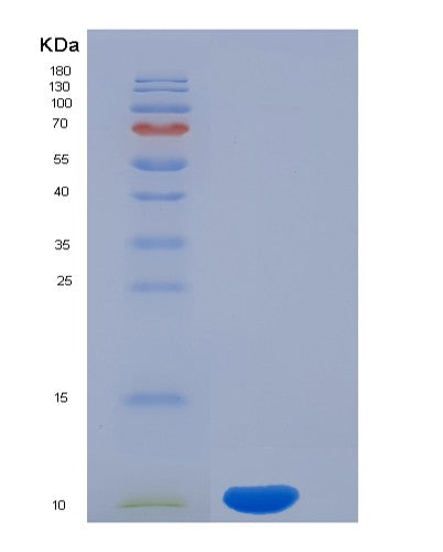 SDS-PAGE analysis of Human CD3D (T-Cell Surface Glycoprotein Cd3 Delta Chain) - Recombinant Protein, showing >85% purity under 15% SDS-PAGE (Reduced)