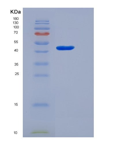 SDS-PAGE analysis of Human CBLIF (Cobalamin Binding Intrinsic Factor) - Recombinant Protein, showing >85% purity under 15% SDS-PAGE (Reduced)