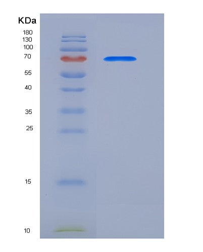 SDS-PAGE analysis of Human CALR (Calreticulin) - Recombinant Protein, showing >85% purity under 15% SDS-PAGE (Reduced)