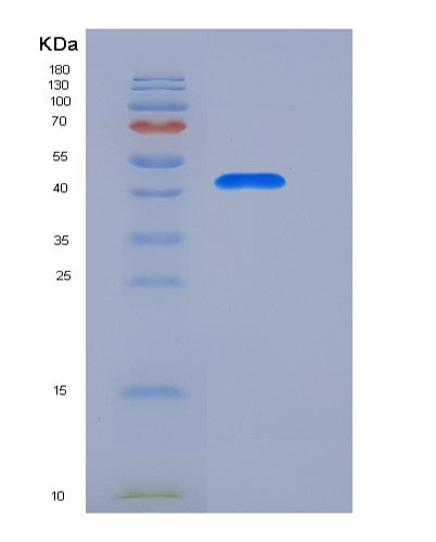 SDS-PAGE analysis of Human REN (Renin) - Recombinant Protein, showing >95% purity under 15% SDS-PAGE (Reduced)