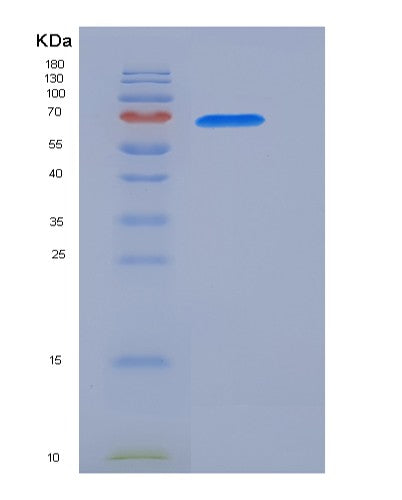 SDS-PAGE analysis of Human GAD1 (Glutamate Decarboxylase 1) - Recombinant Protein, showing >85% purity under 15% SDS-PAGE (Reduced)