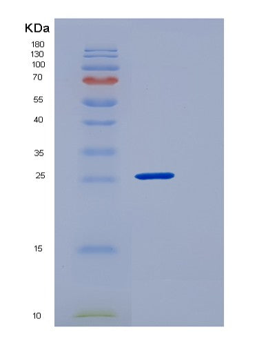 SDS-PAGE analysis of Human CLEC12A (C-Type Lectin Domain Family 12 Member A) - Recombinant Protein, showing >95% purity under 15% SDS-PAGE (Reduced)