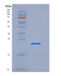SDS-PAGE analysis of Human LCN2 (Neutrophil Gelatinase-Associated Lipocalin) - Recombinant Protein, showing >90% purity under 15% SDS-PAGE (Reduced)
