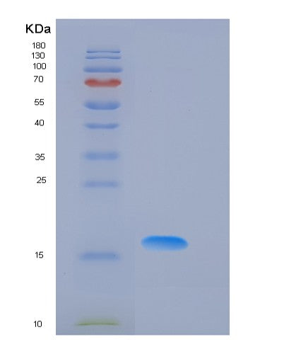 SDS-PAGE analysis of Mouse Fasn (Fatty Acid Synthase) - Recombinant Protein, showing >95% purity under 15% SDS-PAGE (Reduced)
