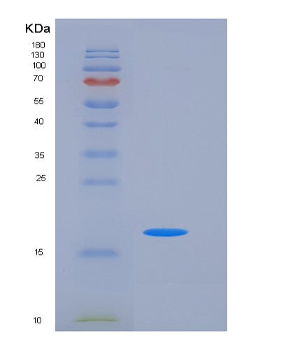 SDS-PAGE analysis of Human NBL1 (Neuroblastoma Suppressor Of Tumorigenicity 1) - Recombinant Protein, showing >85% purity under 15% SDS-PAGE (Reduced)