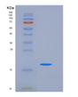 SDS-PAGE analysis of Human NBL1 (Neuroblastoma Suppressor Of Tumorigenicity 1) - Recombinant Protein, showing >85% purity under 15% SDS-PAGE (Reduced)