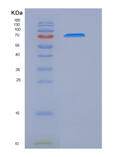 SDS-PAGE analysis of Human IL17RC (Interleukin-17 Receptor C) - Recombinant Protein, showing >95% purity under 15% SDS-PAGE (Reduced)