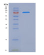 SDS-PAGE analysis of Human IL17RC (Interleukin-17 Receptor C) - Recombinant Protein, showing >95% purity under 15% SDS-PAGE (Reduced)