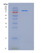 SDS-PAGE analysis of Human CSF3R (Granulocyte Colony-Stimulating Factor Receptor) - Recombinant Protein, showing >85% purity under 15% SDS-PAGE (Reduced)
