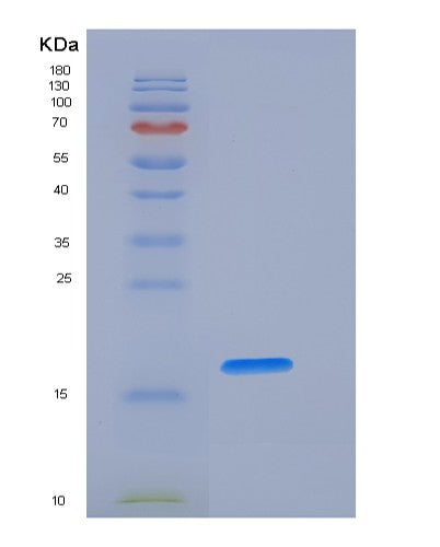 SDS-PAGE analysis of Human FAS (Tumor Necrosis Factor Receptor Superfamily Member 6) - Recombinant Protein, showing >95% purity under 15% SDS-PAGE (Reduced)