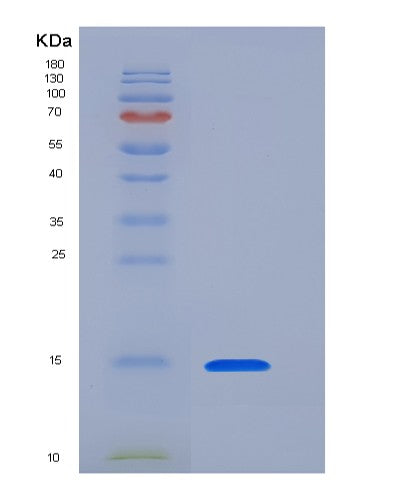 SDS-PAGE analysis of Human CLEC7A (C-Type Lectin Domain Family 7 Member A) - Recombinant Protein, showing >95% purity under 15% SDS-PAGE (Reduced)
