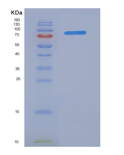 SDS-PAGE analysis of Human FAP (Prolyl Endopeptidase Fap) - Recombinant Protein, showing >85% purity under 15% SDS-PAGE (Reduced)