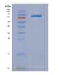 SDS-PAGE analysis of Human FAP (Prolyl Endopeptidase Fap) - Recombinant Protein, showing >85% purity under 15% SDS-PAGE (Reduced)