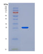 SDS-PAGE analysis of Human CD300LG (Cmrf35-Like Molecule 9) - Recombinant Protein, showing >85% purity under 15% SDS-PAGE (Reduced)