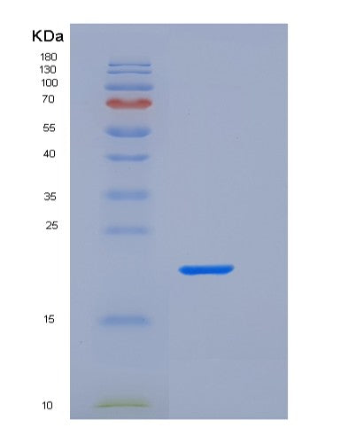 SDS-PAGE analysis of Human FCGR2A (Low Affinity Immunoglobulin Gamma Fc Region Receptor Ii-A) - Recombinant Protein, showing >95% purity under 15% SDS-PAGE (Reduced)