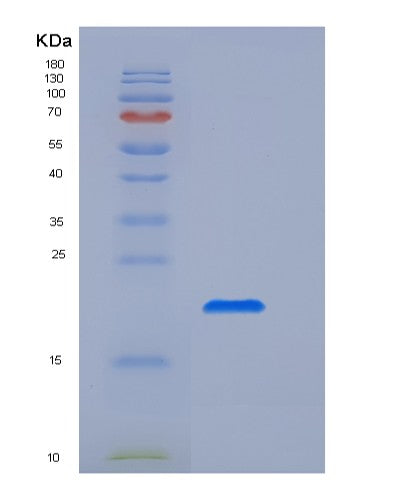 SDS-PAGE analysis of Human FCGR2A (Low Affinity Immunoglobulin Gamma Fc Region Receptor Ii-A) - Recombinant Protein, showing >95% purity under 15% SDS-PAGE (Reduced)