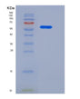 SDS-PAGE analysis of Human MCAM (Cell Surface Glycoprotein Muc18) - Recombinant Protein, showing >85% purity under 15% SDS-PAGE (Reduced)
