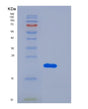 SDS-PAGE analysis of Human TNFRSF1A (Tumor Necrosis Factor Receptor Superfamily Member 1A) - Recombinant Protein, showing >95% purity under 15% SDS-PAGE (Reduced)