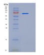 SDS-PAGE analysis of Human DDR2 (Discoidin Domain-Containing Receptor 2) - Recombinant Protein, showing >90% purity under 15% SDS-PAGE (Reduced)