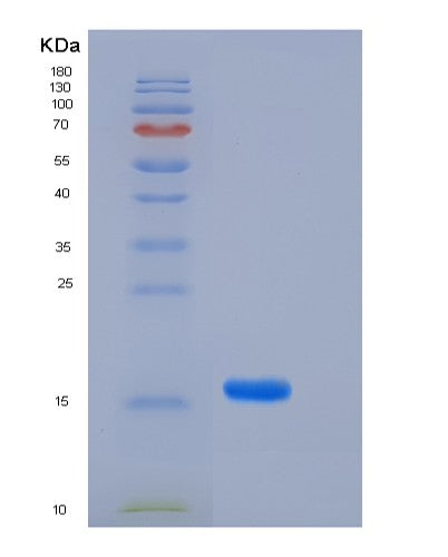 SDS-PAGE analysis of Human FABP4 (Fatty Acid-Binding Protein, Adipocyte) - Recombinant Protein, showing >90% purity under 15% SDS-PAGE (Reduced)